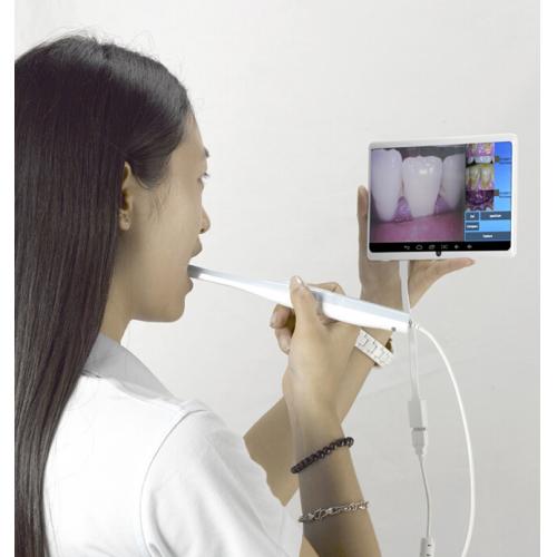 歯科用口腔内カメラCF-683A (USB&OTG&TV) | 歯科販売.com